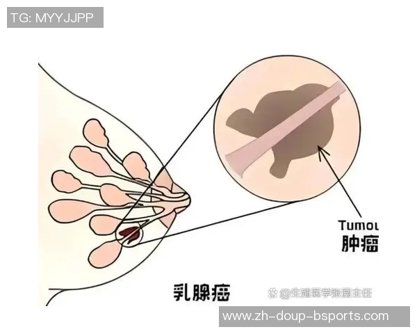 每体：亚马尔承受的耻骨微创手术并不除根，但能有用缓解痛苦
